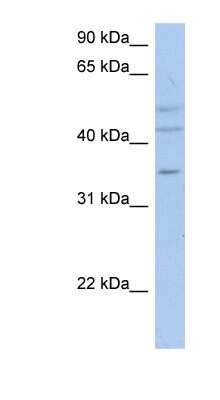 Western Blot: ACPL2 Antibody [NBP1-59507]