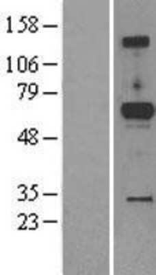 Western Blot: ACPL2 Overexpression Lysate [NBL1-07254]