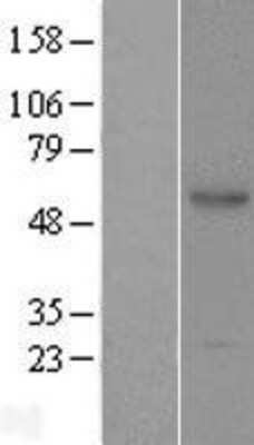 Western Blot: ACPL2 Overexpression Lysate [NBL1-07255]