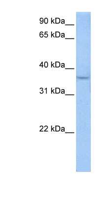 Western Blot: ACPT Antibody [NBP1-62440]