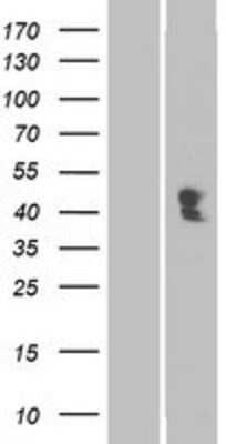 Western Blot: ACPT Overexpression Lysate [NBP2-05929]