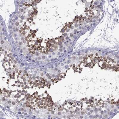 Immunohistochemistry-Paraffin: ACRBP Antibody [NBP1-85407]