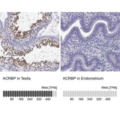 Immunohistochemistry-Paraffin: ACRBP Antibody [NBP1-85407]