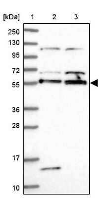 Western Blot: ACRBP Antibody [NBP1-85407]