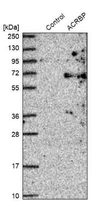 Western Blot: ACRBP Antibody [NBP1-85408]