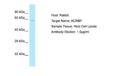 Western Blot: ACRBP Antibody [NBP2-84387]