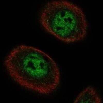 Immunocytochemistry/ Immunofluorescence: ACRC Antibody [NBP3-17118]