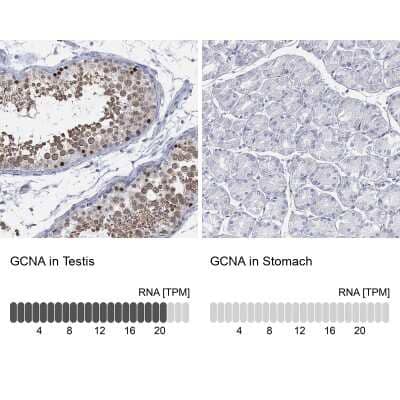 Immunocytochemistry/ Immunofluorescence: ACRC Antibody [NBP3-17118]