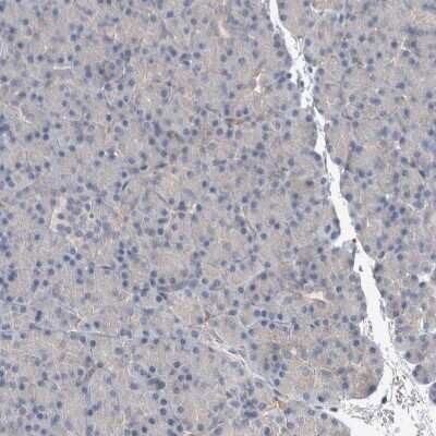 Immunohistochemistry-Paraffin: ACRC Antibody [NBP1-85993]