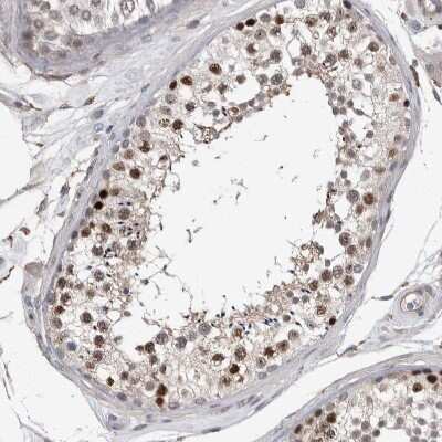 Immunohistochemistry-Paraffin: ACRC Antibody [NBP1-85993]