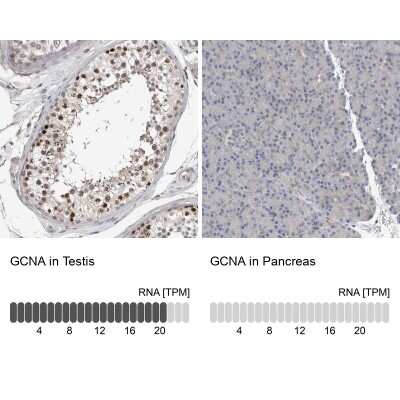 Immunohistochemistry-Paraffin: ACRC Antibody [NBP1-85993]