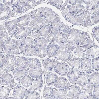Immunohistochemistry-Paraffin: ACRC Antibody [NBP3-17118]