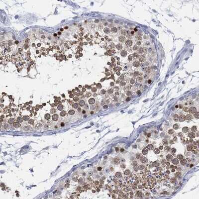 Immunohistochemistry-Paraffin: ACRC Antibody [NBP3-17118]
