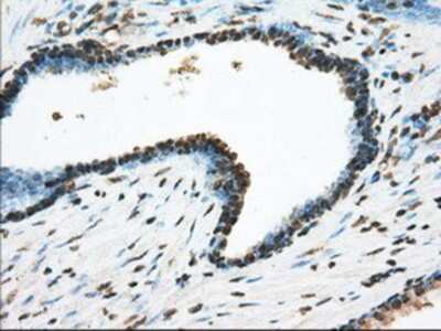 Immunohistochemistry-Paraffin: ACSBG1 Antibody (OTI1D8) [NBP2-02554]