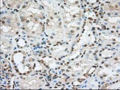 Immunohistochemistry-Paraffin: ACSBG1 Antibody (OTI1D8) [NBP2-02554]