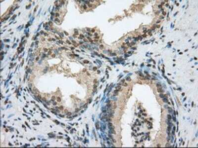 Immunohistochemistry-Paraffin: ACSBG1 Antibody (OTI1D8) [NBP2-02554]