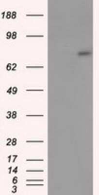 Western Blot: ACSBG1 Antibody (OTI1D8) [NBP2-02554]