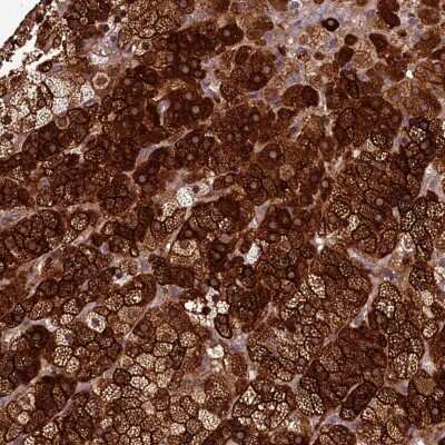 Immunohistochemistry: ACSBG1 Antibody [NBP2-31990]