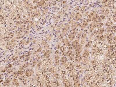 Immunohistochemistry-Paraffin: ACSBG1 Antibody [NBP2-97178]
