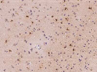 Immunohistochemistry-Paraffin: ACSBG1 Antibody [NBP2-97178]