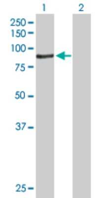 Western Blot: ACSBG1 Antibody [H00023205-B01P]