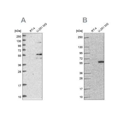 Western Blot: ACSBG1 Antibody [NBP2-31990]