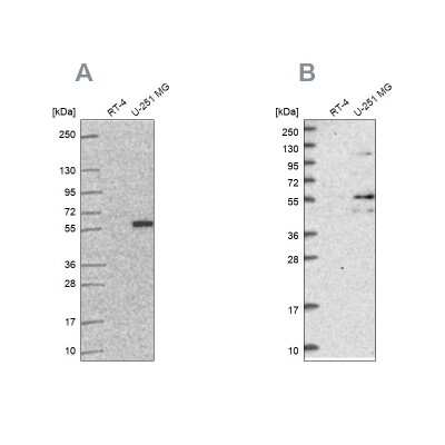 Western Blot: ACSBG1 Antibody [NBP2-58214]