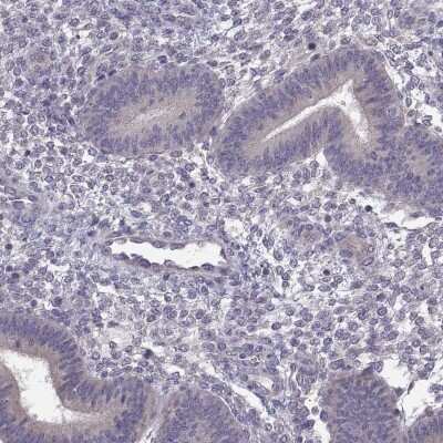 Immunohistochemistry-Paraffin: ACSBG2 Antibody [NBP1-88642]