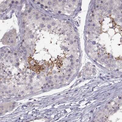 Immunohistochemistry-Paraffin: ACSBG2 Antibody [NBP1-88642]