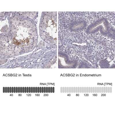 Immunohistochemistry-Paraffin: ACSBG2 Antibody [NBP1-88642]