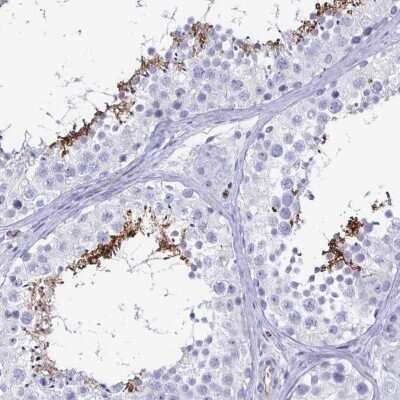 Immunohistochemistry-Paraffin: ACSBG2 Antibody [NBP2-33603]