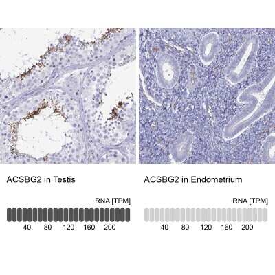 Immunohistochemistry-Paraffin: ACSBG2 Antibody [NBP2-33603]