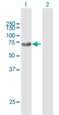 Western Blot: ACSBG2 Antibody [H00081616-B01P]