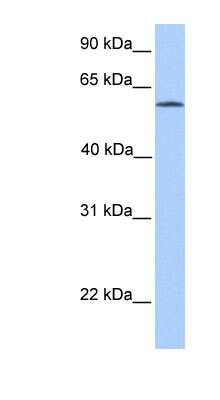 Western Blot: ACSBG2 Antibody [NBP1-54963]