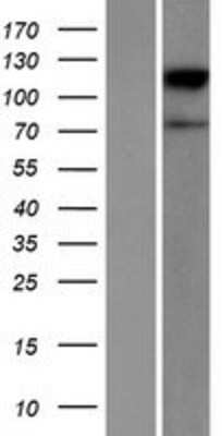 Western Blot: ACSBG2 Overexpression Lysate [NBP2-06163]