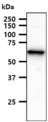 Western Blot: ACSF2 Antibody (18B4)BSA Free [NBP2-59501]