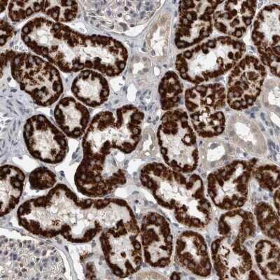 Immunohistochemistry-Paraffin: ACSF2 Antibody [NBP2-47558]