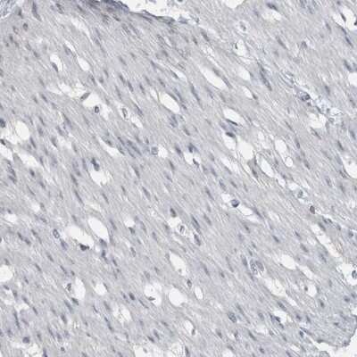 Immunohistochemistry-Paraffin: ACSF2 Antibody [NBP2-47558]