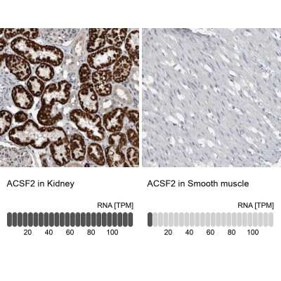 Immunohistochemistry-Paraffin: ACSF2 Antibody [NBP2-47558]