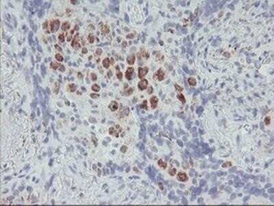 Immunohistochemistry: ACSF2 Antibody (OTI6E4) - Azide and BSA Free [NBP2-72220]