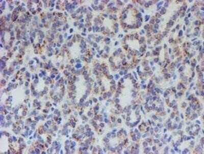 Immunohistochemistry: ACSF2 Antibody (OTI6E4) - Azide and BSA Free [NBP2-72220]