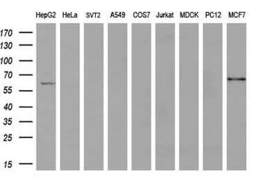 Western Blot: ACSF2 Antibody (OTI6E4)Azide and BSA Free [NBP2-72220]