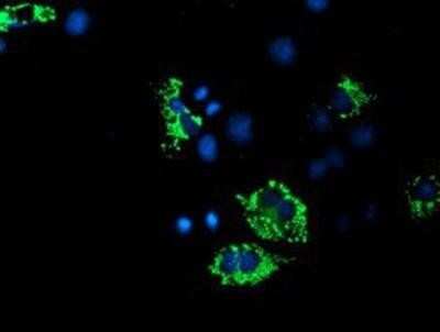 Immunocytochemistry/ Immunofluorescence: ACSF2 Antibody (OTI6E4) [NBP2-02027]