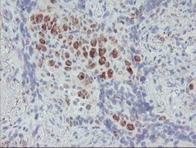Immunohistochemistry-Paraffin: ACSF2 Antibody (OTI6E4) [NBP2-02027]