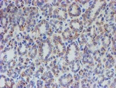 Immunohistochemistry-Paraffin: ACSF2 Antibody (OTI6E4) [NBP2-02027]