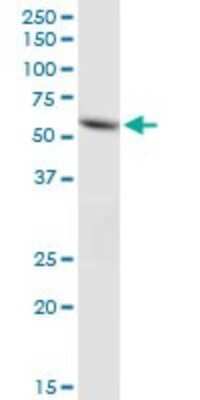Western Blot: ACSF2 Antibody [H00080221-B01P]