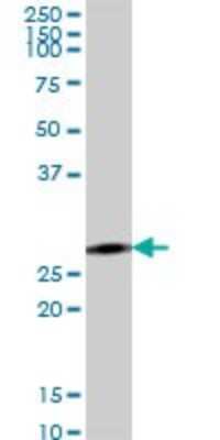 Western Blot: ACSF2 Antibody [H00080221-B01P]