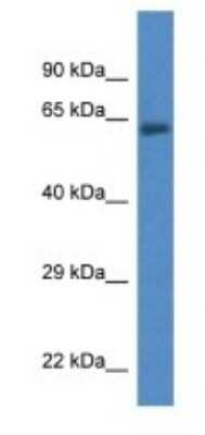 Western Blot: ACSF2 Antibody [NBP1-74274]