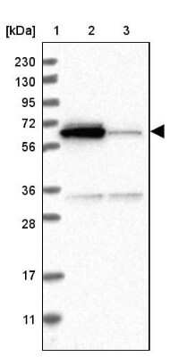 Western Blot: ACSF2 Antibody [NBP2-47558]