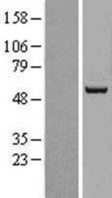 Western Blot: ACSF2 Overexpression Lysate [NBL1-07261]